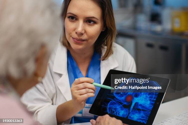 doctor explaining results of mri scan of brain to senior patient. diagnosis of diseases for elderly people. examination of brain, detecting stroke, dementia, head injures or neurological disorders. - brain and spinal cord mri stock pictures, royalty-free photos & images