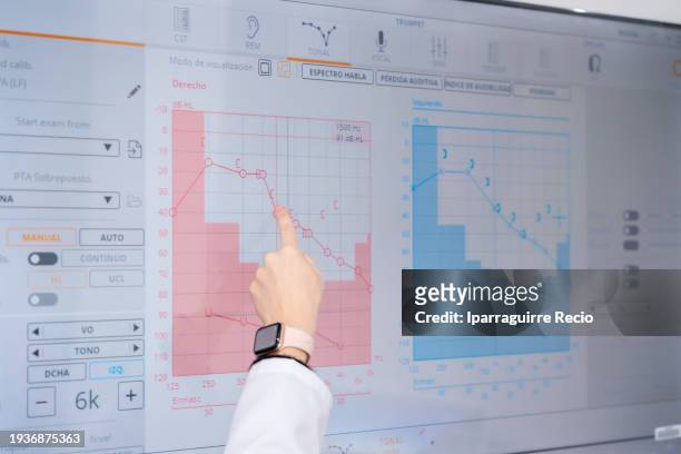 doctor pointing data in a screen of a hearing test - otoscope fotografías e imágenes de stock