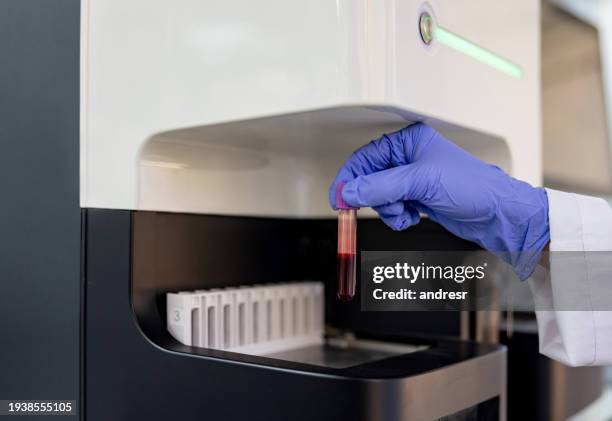 Blood Sampling Machine 795 Blood Testing Machine Stock Photos, High-Res Pictures, and Images ...