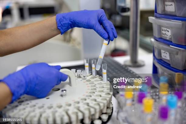 primo piano su un ematologo che analizza campioni medici in laboratorio - provetta per campioni ematici foto e immagini stock
