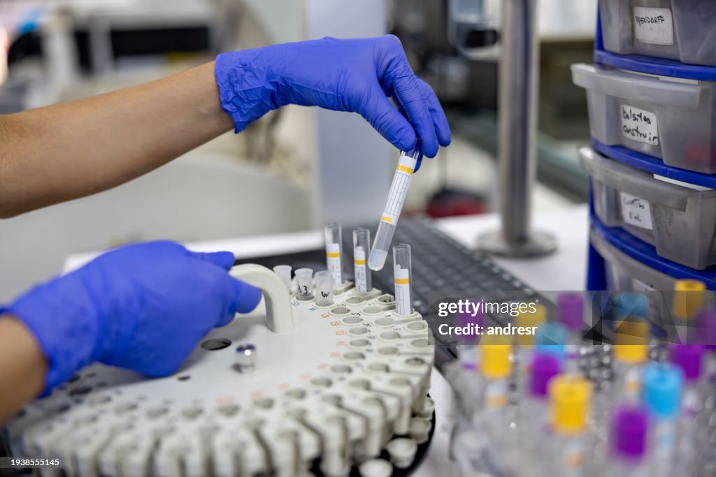 Close-up on a hematologist analyzing medical samples at the laboratory