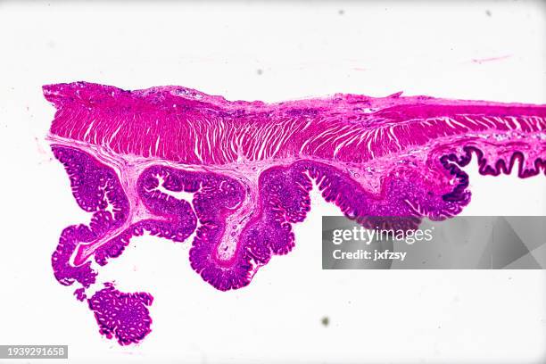 amostra histológica esôfago - secção do departamento cardíaco sob microscopia de luz com fundo branco - lâmina-de-microscópio - fotografias e filmes do acervo