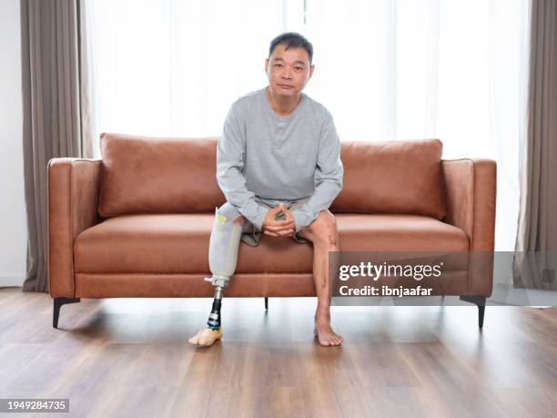 homme handicapé assis et regardant la caméra - amputé photos et images de collection