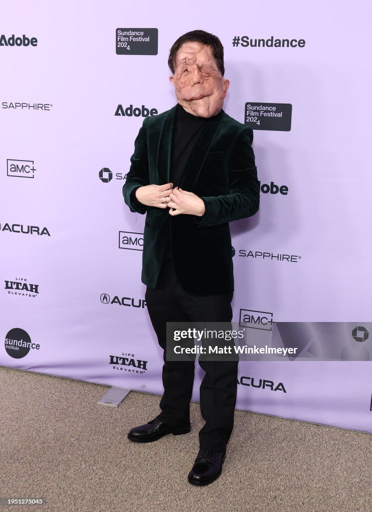 Adam Pearson attends the "A Different Man" Premiere during the 2025