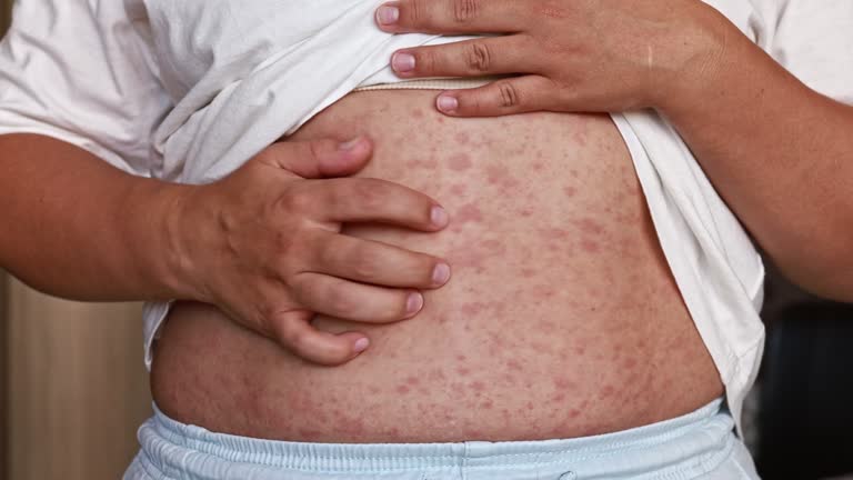Overweight Rash Overweight Woman Uncomfortable Videos and HD Footage - Getty Images