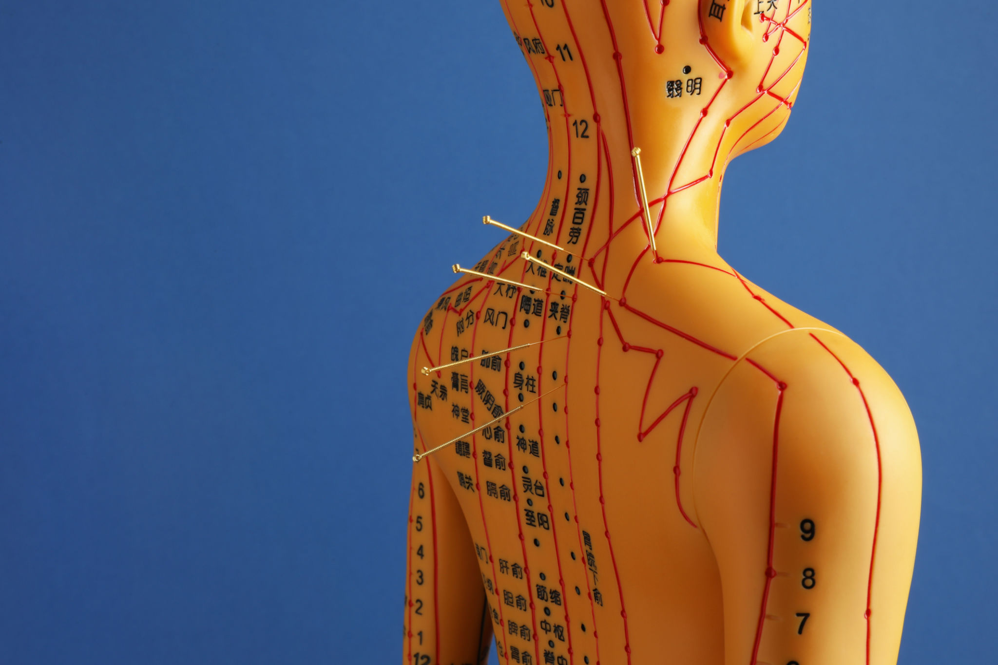 Acupuncture - alternative medicine. Human model with needles in back on blue background, space for text Acupuncture - alternative medicine. Human model with needles in back on blue background, space for text
