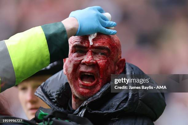 An injured fan is given medical treatment after tempers flared between fans of West Bromwich Albion and police during the Emirates FA Cup Fourth...