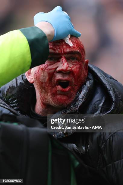 An injured fan is given medical treatment after tempers flared between fans of West Bromwich Albion and police during the Emirates FA Cup Fourth...