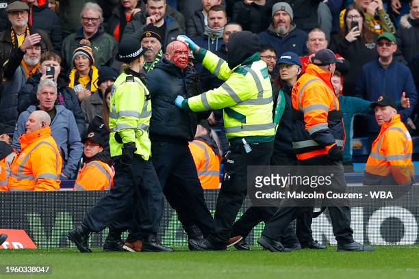 Supporter with blood on his face is helped from the stadium during the Emirates FA Cup Fourth Round match between West Bromwich Albion and...
