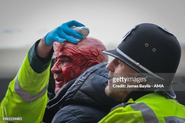 Fan with a bloodied face is given medical treatment during the Emirates FA Cup Fourth Round match between West Bromwich Albion and Wolverhampton...
