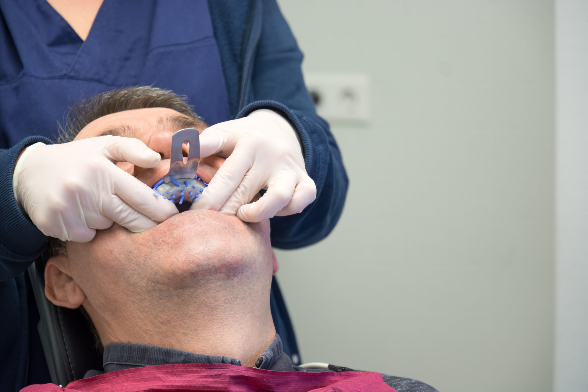 dental model