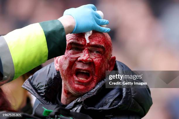 Fan with a bloodied face is escorted away by local police during the Emirates FA Cup Fourth Round match between West Bromwich Albion and...