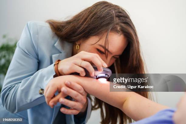 dermatologist is using dermatoscope for arm skin examination - melanoma foto e immagini stock