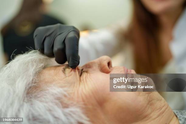 plastischer chirurg bereitet sich auf blepharoplastik vor - augenlid stock-fotos und bilder