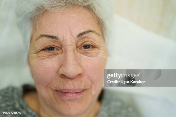 surgeon making pre surgery marks on aged lady face - plastic surgery marks stock pictures, royalty-free photos & images