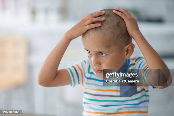 diciéndole adiós a mi cabello - alopecia fotografías e imágenes de stock