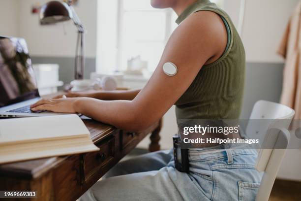 teenage girl studying at home, doing homework while wearing continuous glucose monitor at arm. - glucose stockfoto's en -beelden
