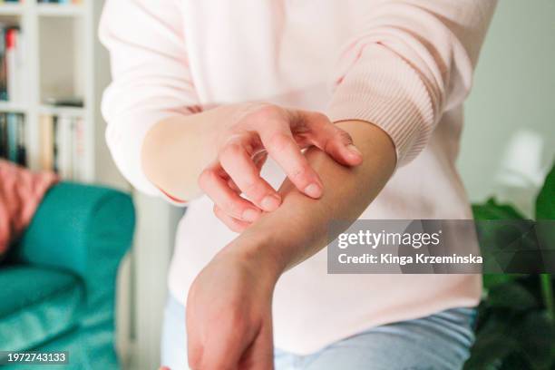 itchiness - arranhar imagens e fotografias de stock