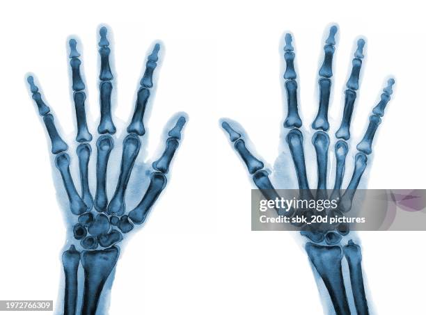 woman hand 2 - skelett hand stock-fotos und bilder