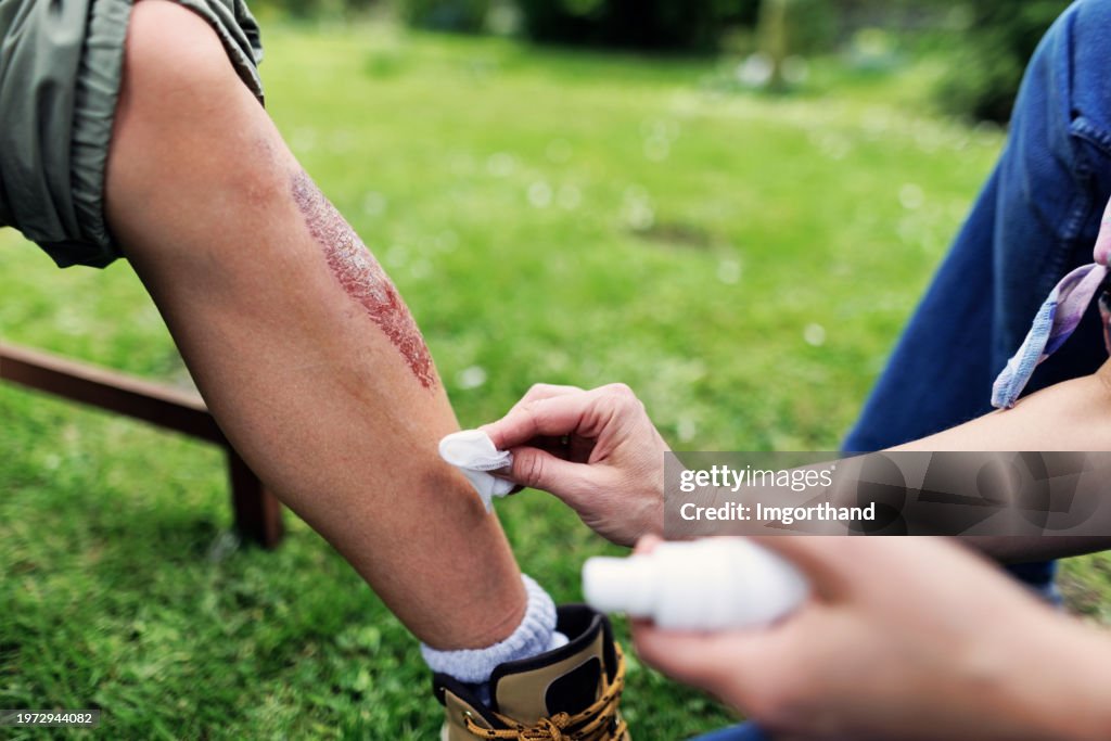 Mother tending to her son's wounded leg with adhesive plaster bandage and sterile gauze pads