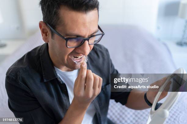 uomo che applica l'allineatore di denti invisibile - sbiancamento dentale foto e immagini stock