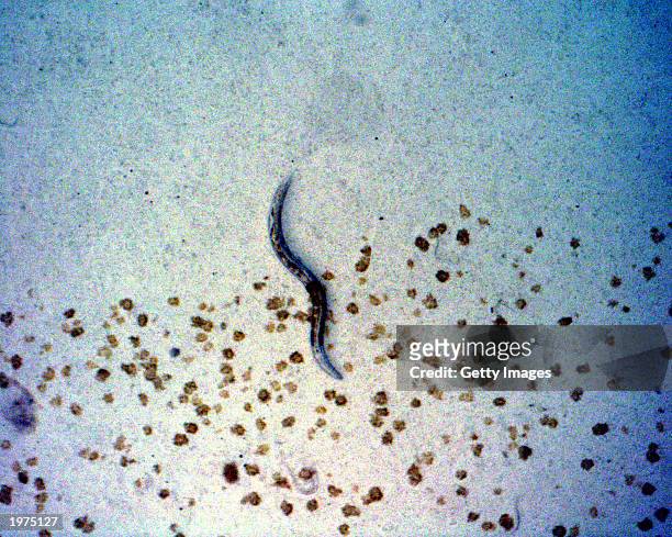 Elegans nemotodes, or round worms, undergo examination by project scientists May 1, 2003 at the Kennedy Space Center in Florida. The worms were found...