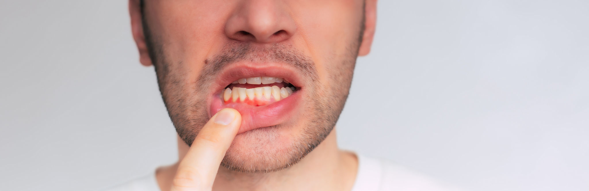 gum disease treatment