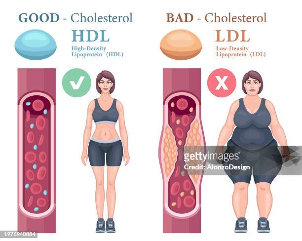 stockillustraties, clipart, cartoons en iconen met types of cholesterol in the blood concept. high-density lipoprotein (hdl) and low-density lipoprotein (ldl). - high density lipoprotein