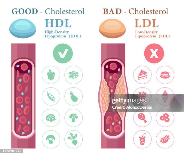 types of cholesterol in the blood concept. high-density lipoprotein (hdl) and low-density lipoprotein (ldl). - atherosklerose stock-grafiken, -clipart, -cartoons und -symbole
