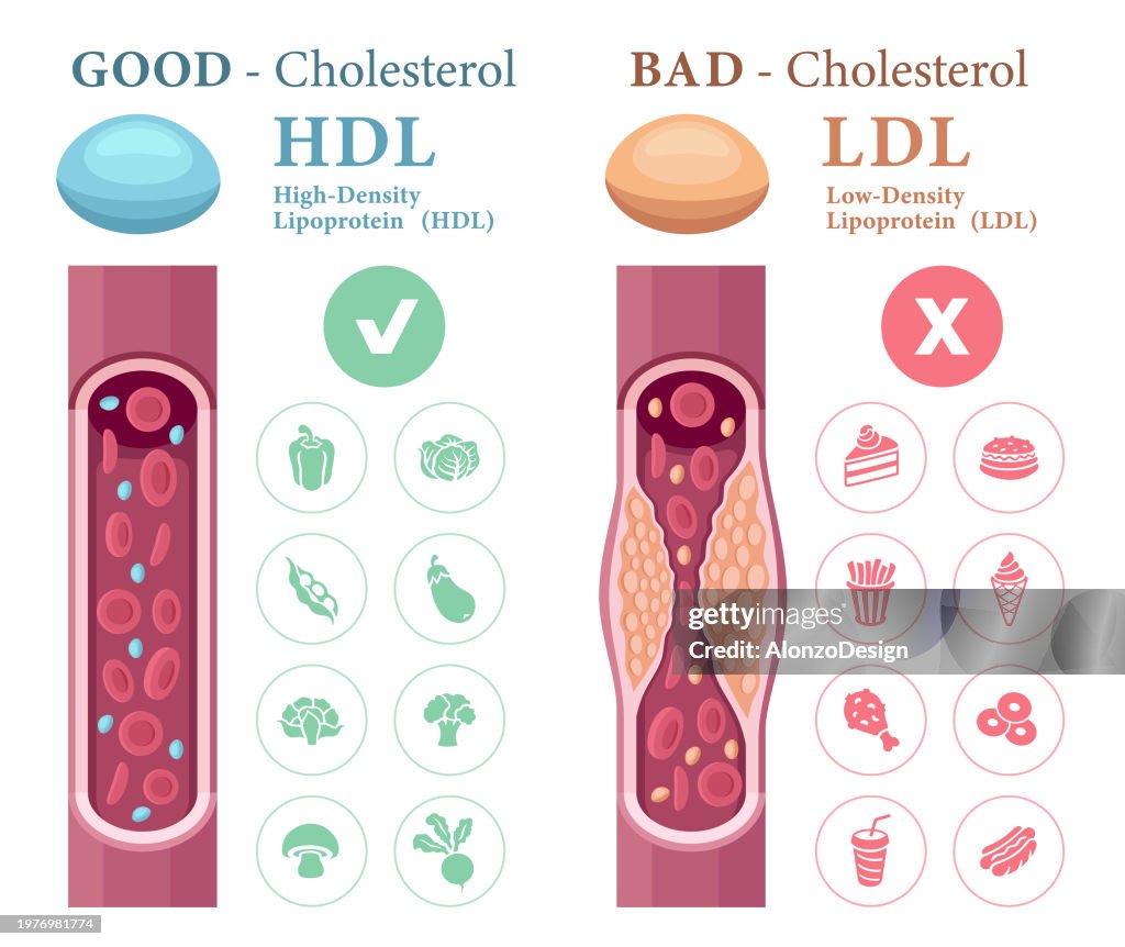 Types of cholesterol in the blood concept. High-Density Lipoprotein (HDL) and Low-Density Lipoprotein (LDL).