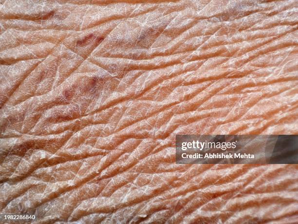 skin macro - arrugado fotografías e imágenes de stock