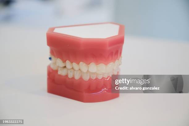 dental mould with aligners in a clinic - dentures stock pictures, royalty-free photos & images