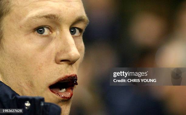 England's Jonny Wilkinson, with a bloodied lip, looks on from the bench during the RBS Six Nations match between England and Scotland, at Twickenham...