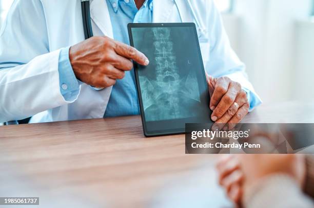 close-up of male physician pointing at spinal x-ray on digital tablet to patient in clinic - backbone stock pictures, royalty-free photos & images