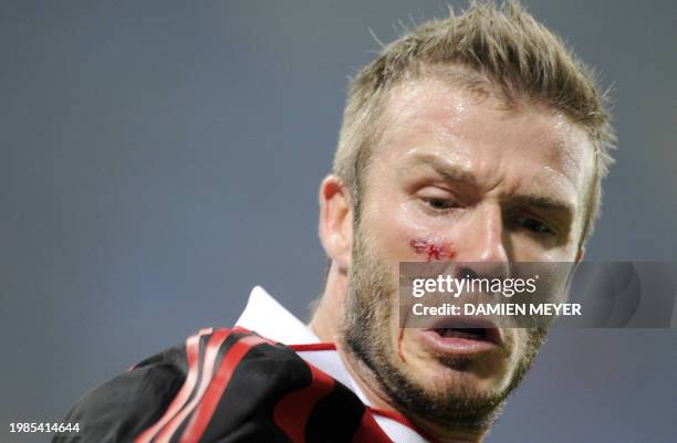 Milan's English midfielder David Beckham is injured on his right cheek during the Italian Serie A football match AC Milan against Chievo on March 14,...