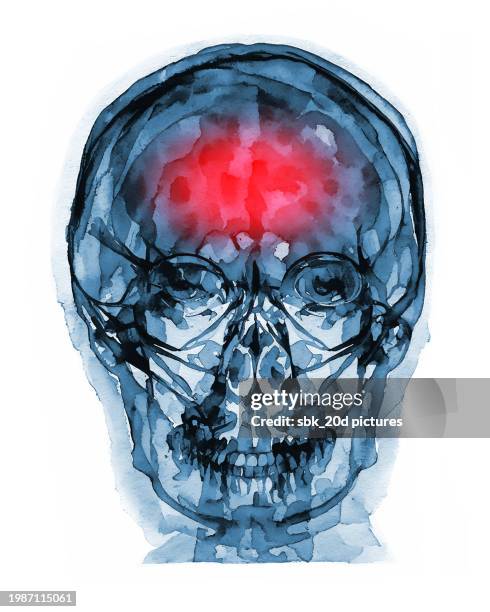 skull f 16 - ibuprofen stock pictures, royalty-free photos & images