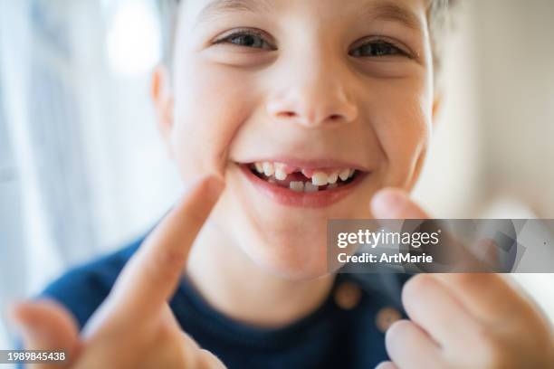 cute little boy smiling with a milky tooth gap - tooth fairy stockfoto's en -beelden