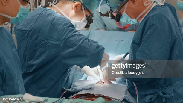 medical team performing surgical operation - heart surgery stock pictures, royalty-free photos & images