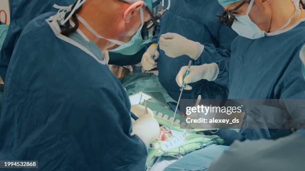 performing a complex surgical procedure - heart bypass stock pictures, royalty-free photos & images