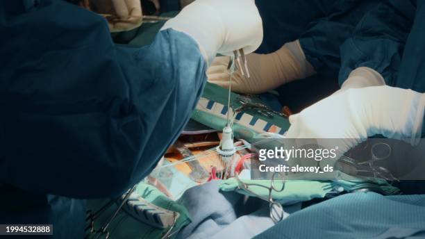 heart valve installation stage - heart bypass stock pictures, royalty-free photos & images