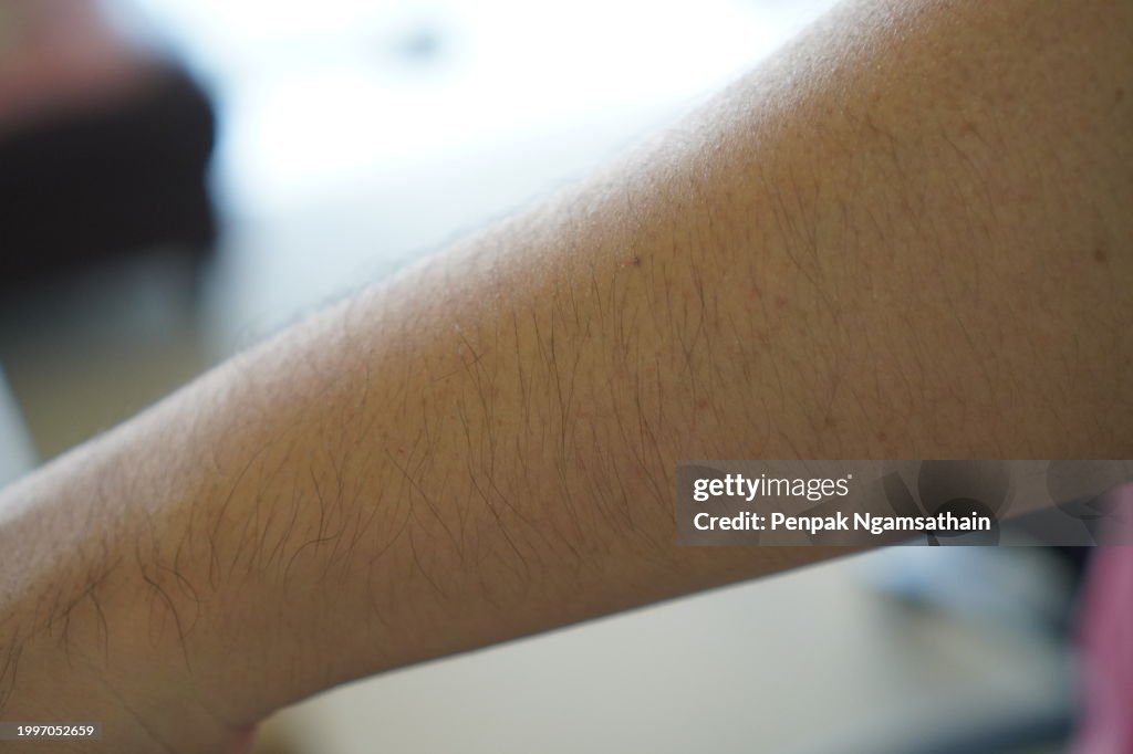Arm hair