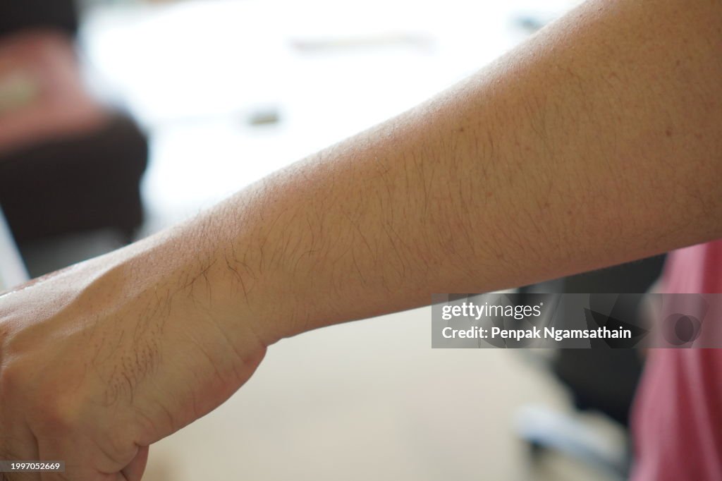 Arm hair