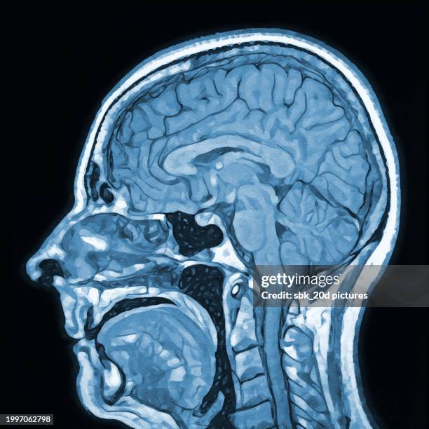 skull mri 02 - ibuprofen stock pictures, royalty-free photos & images
