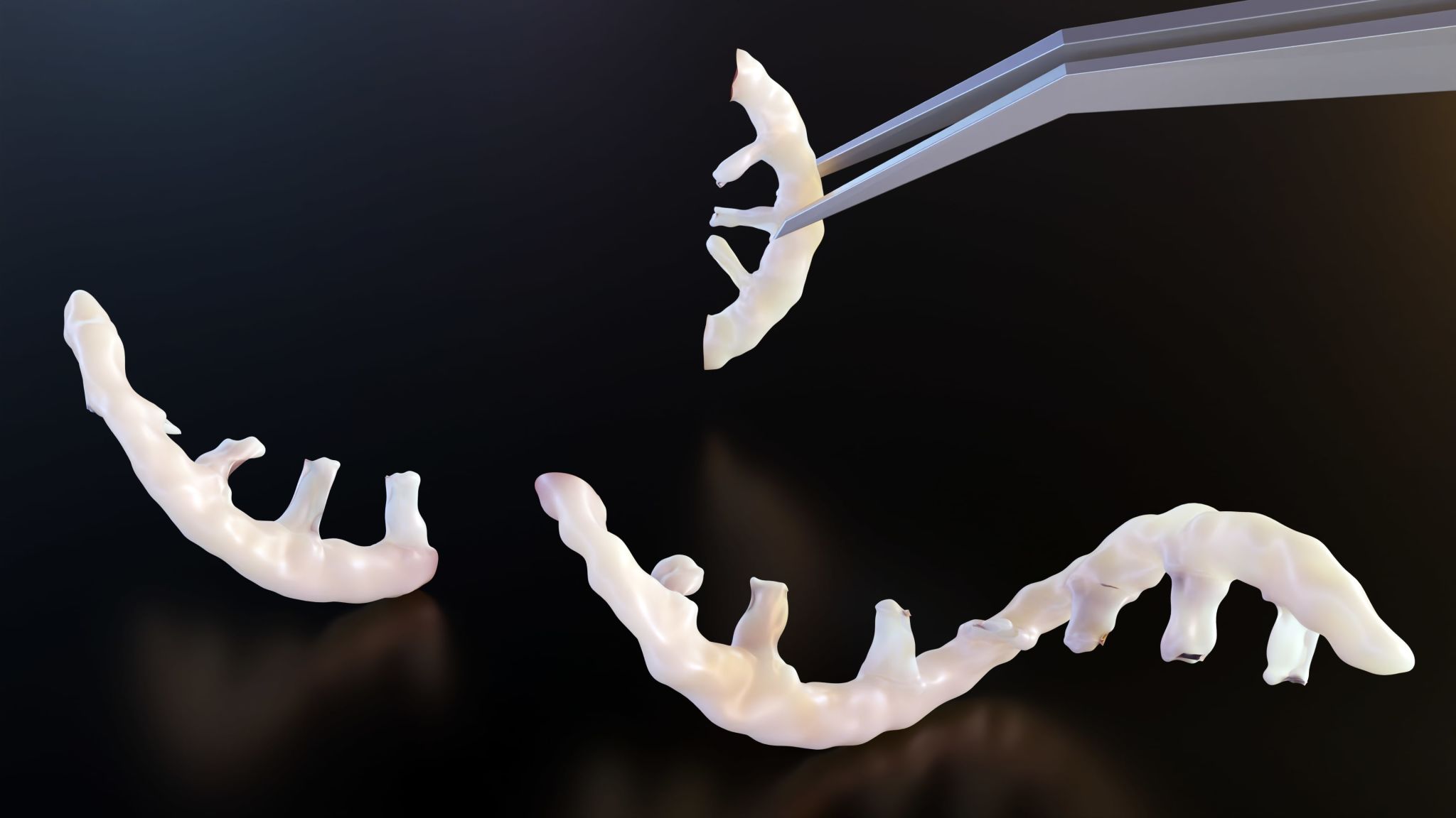 3d druck implantat