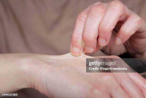 skin test - squeezing stock pictures, royalty-free photos & images