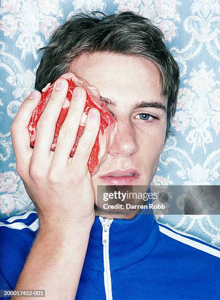 young man holding piece of meat to face, portrait, close-up - black eye stockfoto's en -beelden