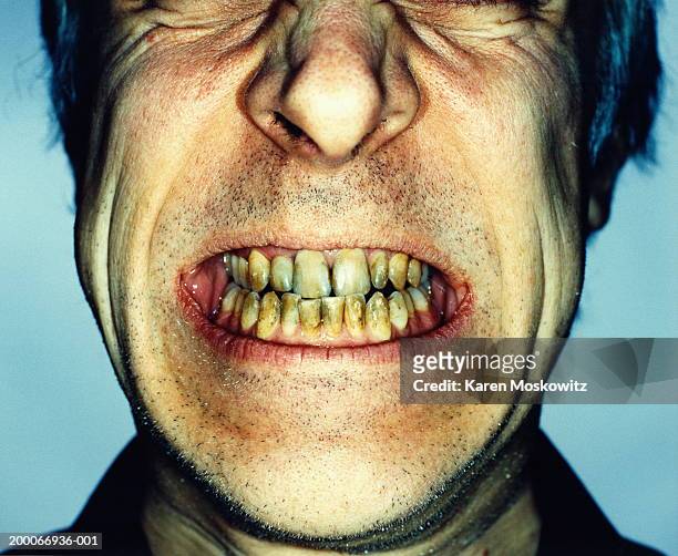 943 Ugly Teeth Photos and Premium High Res Pictures - Getty Images
