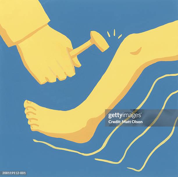 doctor using reflex hammer on patient's knee - reflex hammer stock illustrations