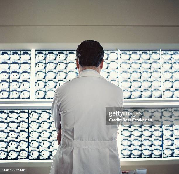 doctor looking at x-rays, rear view - radioloog stockfoto's en -beelden