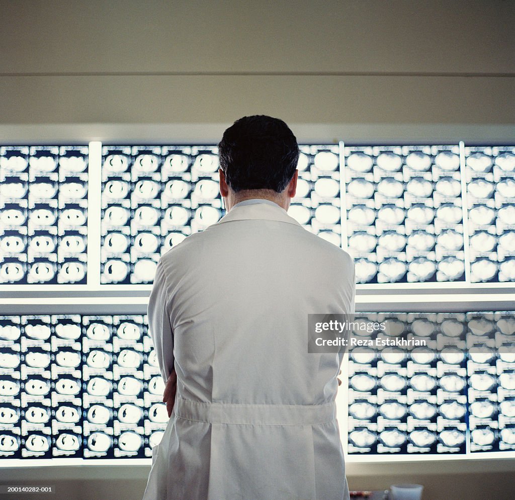 Doctor looking at x-rays, rear view